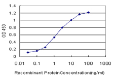 10 - TRIM16 Antibody (monoclonal) (M01) AT4341a