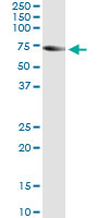 5 - TRIM16 Antibody (monoclonal) (M01) AT4341a