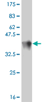 1 - TRIM16 Antibody (monoclonal) (M01) AT4341a