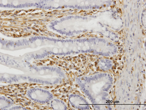 2 - TRIM16 Antibody (monoclonal) (M02) AT4342a