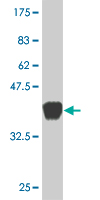 1 - TRIM16 Antibody (monoclonal) (M02) AT4342a