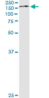5 - TRIM24 Antibody (monoclonal) (M01) AT4345a