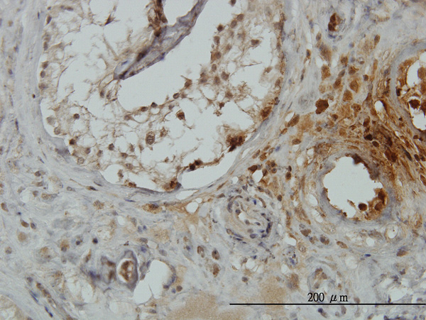 2 - TRIM49 Antibody (monoclonal) (M01) AT4356a