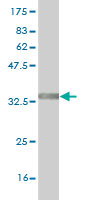 1 - TRIM49 Antibody (monoclonal) (M01) AT4356a