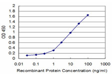 10 - TRIM49 Antibody (monoclonal) (M05) AT4357a