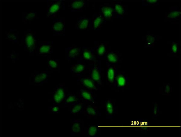 3 - TRIM49 Antibody (monoclonal) (M05) AT4357a