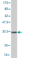 1 - TRIM49 Antibody (monoclonal) (M05) AT4357a