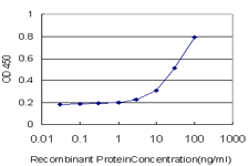 10 - TRIM52 Antibody (monoclonal) (M01) AT4359a