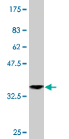 1 - TRIM52 Antibody (monoclonal) (M01) AT4359a