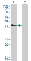 1 - TRIM52 Antibody (monoclonal) (M01) AT4359a