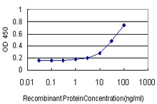 10 - TRIP13 Antibody (monoclonal) (M02) AT4363a
