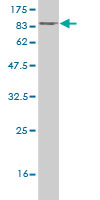 1 - TRIP13 Antibody (monoclonal) (M02) AT4363a
