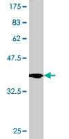 1 - TRPA1 Antibody (monoclonal) (M03) AT4367a