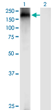 1 - TRPA1 Antibody (monoclonal) (M03) AT4367a