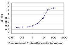 10 - TRPC4AP Antibody (monoclonal) (M07) AT4368a