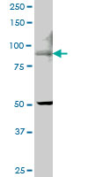 1 - TRPV5 Antibody (monoclonal) (M06) AT4372a