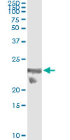 5 - TSC22D3 Antibody (monoclonal) (M01) AT4374a