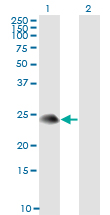 1 - TSC22D3 Antibody (monoclonal) (M01) AT4374a