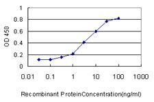 10 - TSC22D4 Antibody (monoclonal) (M06) AT4375a
