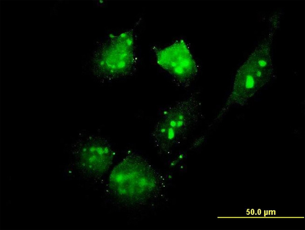 3 - TSC22D4 Antibody (monoclonal) (M06) AT4375a