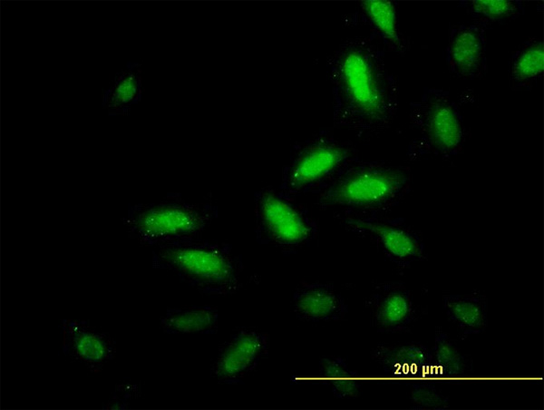 3 - TSC22D4 Antibody (monoclonal) (M07) AT4376a