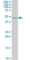 1 - TSC22D4 Antibody (monoclonal) (M07) AT4376a