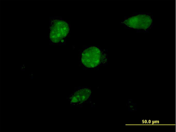 3 - TSC22D4 Antibody (monoclonal) (M08) AT4377a