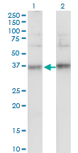 1 - TSPAN32 Antibody (monoclonal) (M02) AT4380a