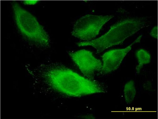 3 - TSSC1 Antibody (monoclonal) (M01) AT4382a