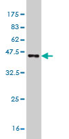 1 - TSSC1 Antibody (monoclonal) (M01) AT4382a