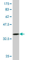 1 - TSSK1 Antibody (monoclonal) (M01) AT4383a