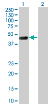 1 - TSSK1 Antibody (monoclonal) (M01) AT4383a