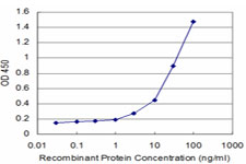 10 - TSSK1 Antibody (monoclonal) (M02) AT4384a