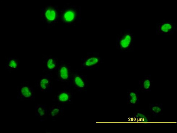 3 - TSSK1 Antibody (monoclonal) (M02) AT4384a