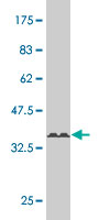1 - TSSK1 Antibody (monoclonal) (M02) AT4384a