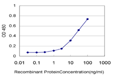 10 - TTC3 Antibody (monoclonal) (M09) AT4387a