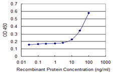 10 - TTYH1 Antibody (monoclonal) (M04) AT4396a