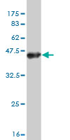 1 - TTYH1 Antibody (monoclonal) (M04) AT4396a