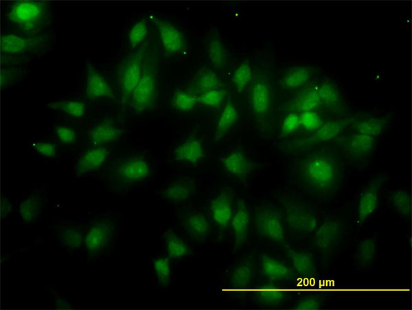 3 - TUBG2 Antibody (monoclonal) (M01) AT4407a