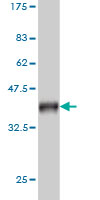 1 - TUBG2 Antibody (monoclonal) (M01) AT4407a