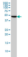 1 - TUBG2 Antibody (monoclonal) (M01) AT4407a