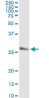 5 - TWIST1 Antibody (monoclonal) (M01) AT4410a