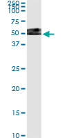 5 - TXNDC4 Antibody (monoclonal) (M01) AT4417a