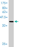 1 - TXNL4A Antibody (monoclonal) (M01) AT4420a