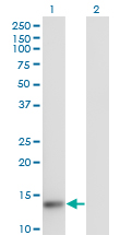 1 - TXNL4A Antibody (monoclonal) (M01) AT4420a