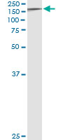 5 - TYK2 Antibody (monoclonal) (M01) AT4423a