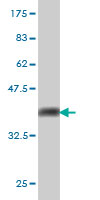 1 - UBE2E2 Antibody (monoclonal) (M01) AT4434a