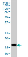 1 - UBE2G2 Antibody (monoclonal) (M01) AT4436a