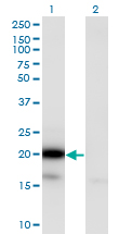 1 - UBE2G2 Antibody (monoclonal) (M01) AT4436a