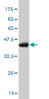 1 - UBE2J1 Antibody (monoclonal) (M01) AT4438a